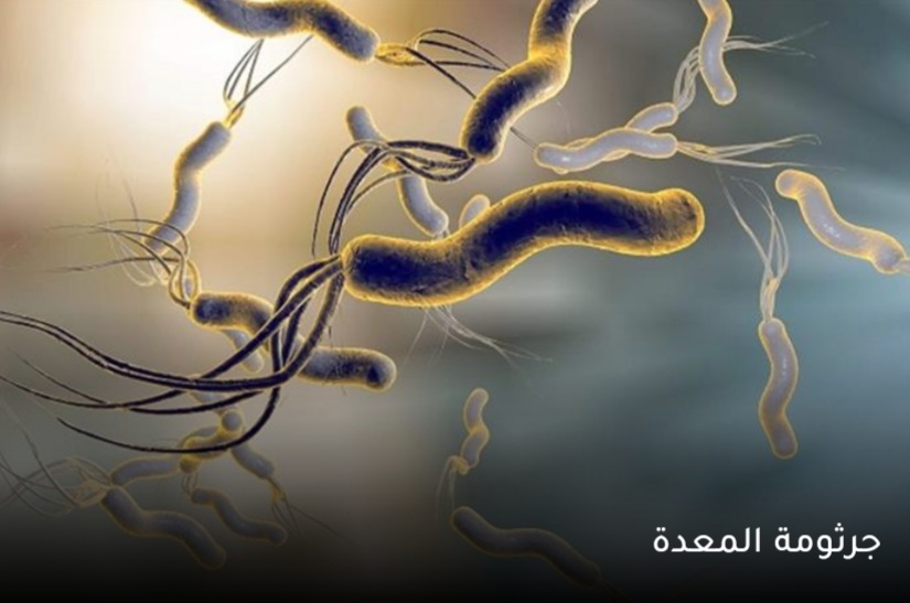  علاج جرثومة المعدة بطرق طبيعية: 5 وسائل فعالة بدون أدوية