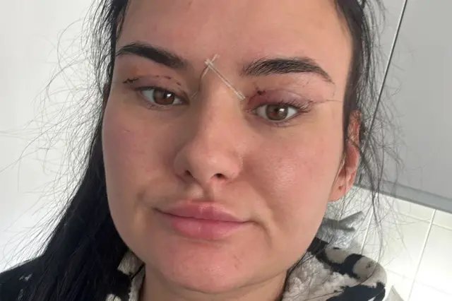 ����