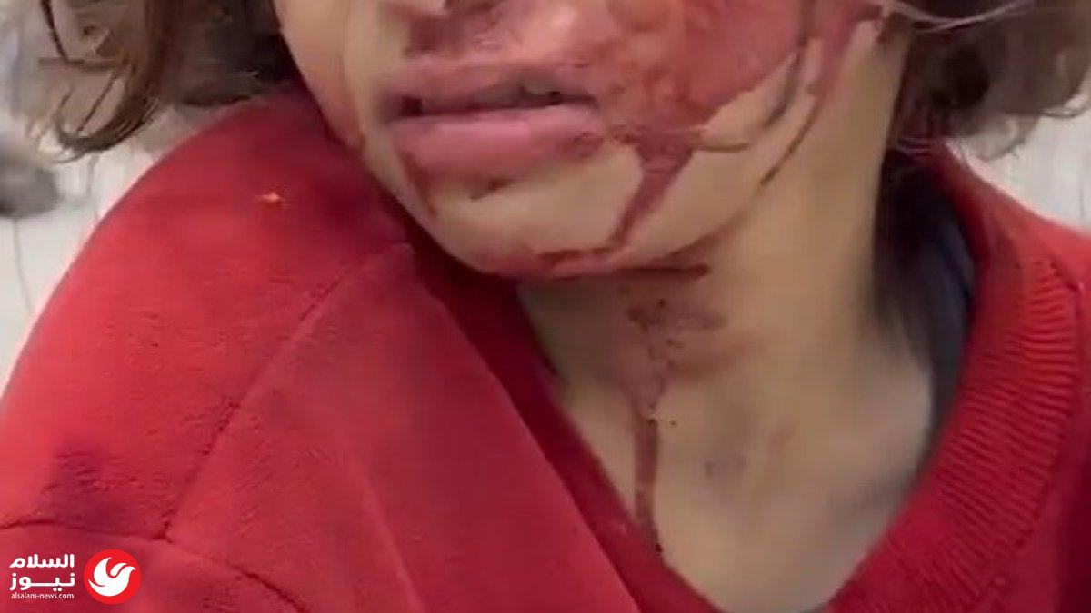 قانوني فلسطيني: استهداف الاحتلال للنساء في غزة يندرج ضمن الإبادة الجماعية